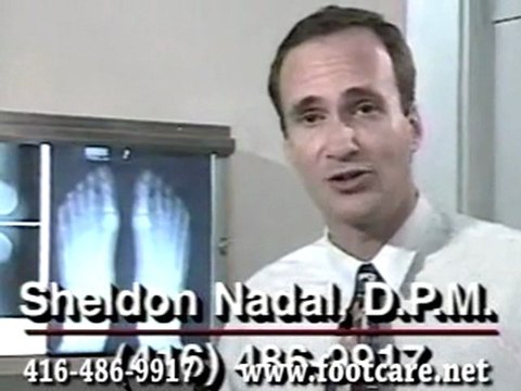 Minimal Invasive Bunion Surgery - foot Doctor of Podiatric Medicine, Foot Specialist, Toronto