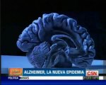 Alzheimer: Las monjas de Snowdon (Reserva cognitiva)