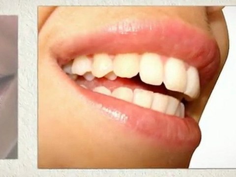 Cosmetic Dentist Plymouth - 7 Top Tips For Choosing A Cosmetic Dentist