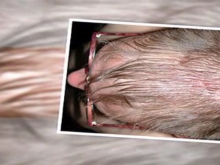 The Best Treatment For Itchy Scalp