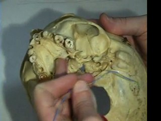 анатомия черепа