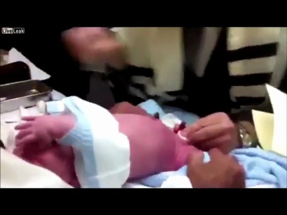 La Circoncision D Apres Le Talmud Video Dailymotion