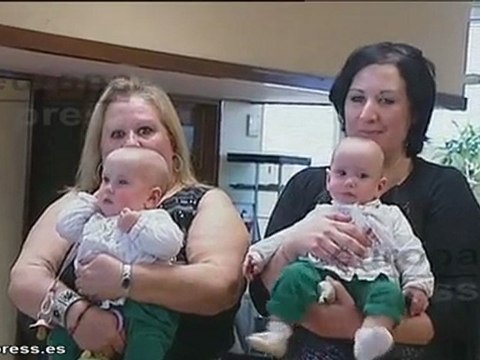 Vall d'Hebron separa a dos siamesas