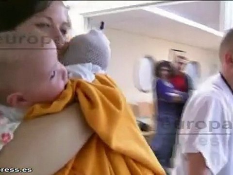 Dos siamesas inician una nueva vida por separado