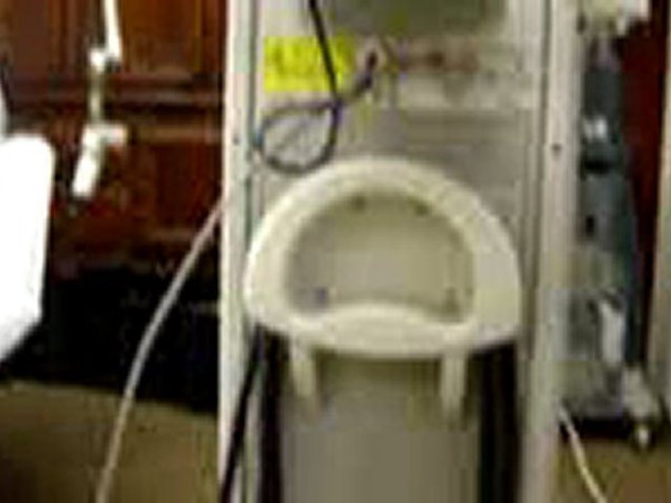 Lumenis UltraPulse Laser For Sale