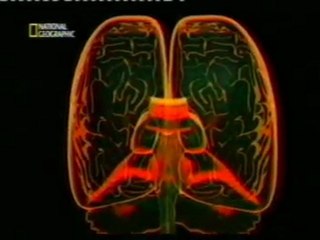 Daño cerebral por impactos laterales: Seguridad vial
