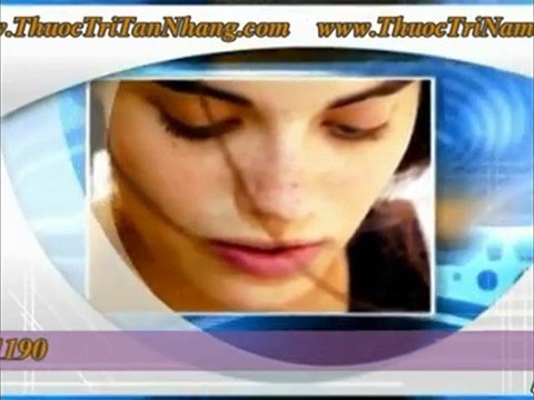 Điều trị nám tan nhang hiệu quả phần 2