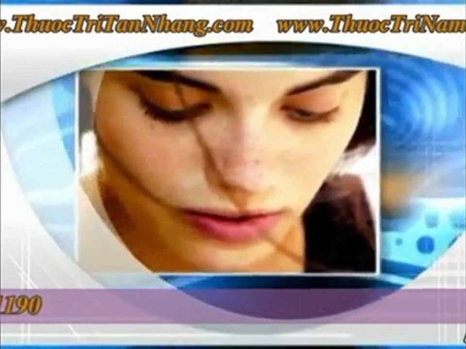 Điều trị nám tan nhang hiệu quả phần 2
