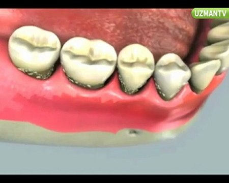 Diş eti sorunları nelerdir?-Nazlı Menemencioğlu