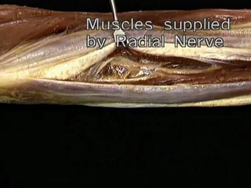 Upper limb--Part 3(b)