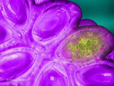 Oncology_ Cancer (Animated Pocket Dictionary)