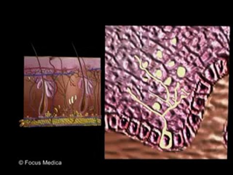 Albinism (Animated Pocket Dictionary_ Dermatology)