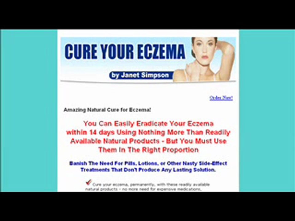 Cure Your Eczema in 14 Days - Proven and Natural Way
