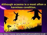 Symptoms And Causes of Eczema And How To Treat Naturally