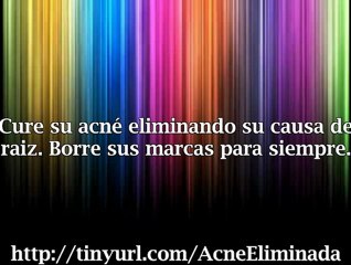 COMO CURAR EL ACNE GUIA PARA ELIMINARLA