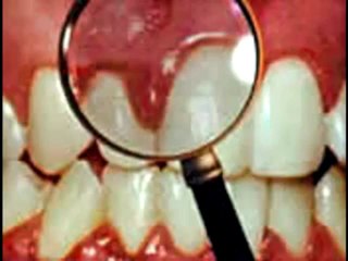 ALLTV QNA 16JUN DENTAL