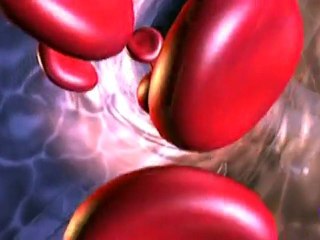 Aterosclerosis: Celulas madre