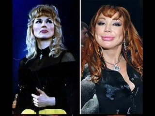 Жертвы пластической хирургии