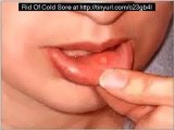 How to Remove Cold Sores Quickly and Easy Fast