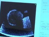 Low-cost ultrasound scanner unveiled in UK