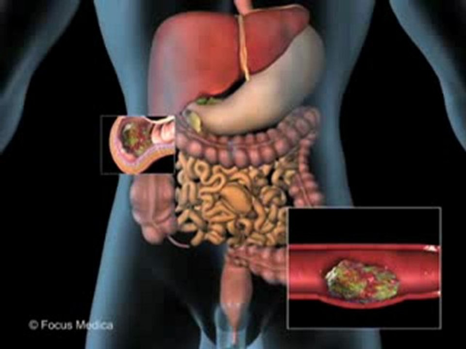 Gastroenterology (Animated Pocket Dictionary)