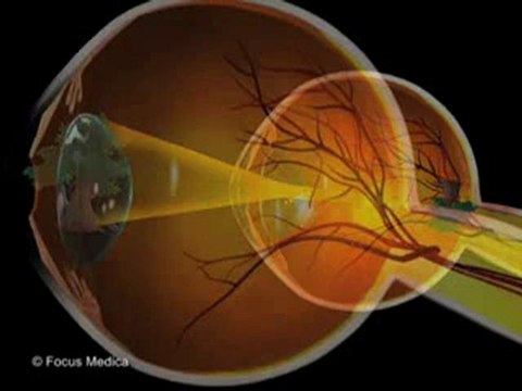 Ophthalmology (Animated Pocket Dictionary)