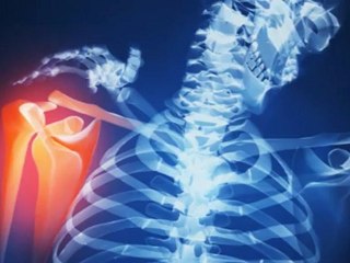 Magnetoterapia, fisioterapia para el tratamiento de esguinces.