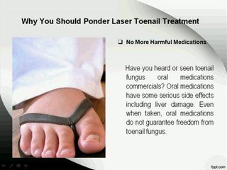 Why You Should Consider Laser Toenail Treatment