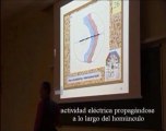 Neurologia 20 - Crisis motoras y alucinaciones sensoriales - Prof Manuel Lafarga