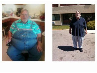 The Skinny Fiber Revolution