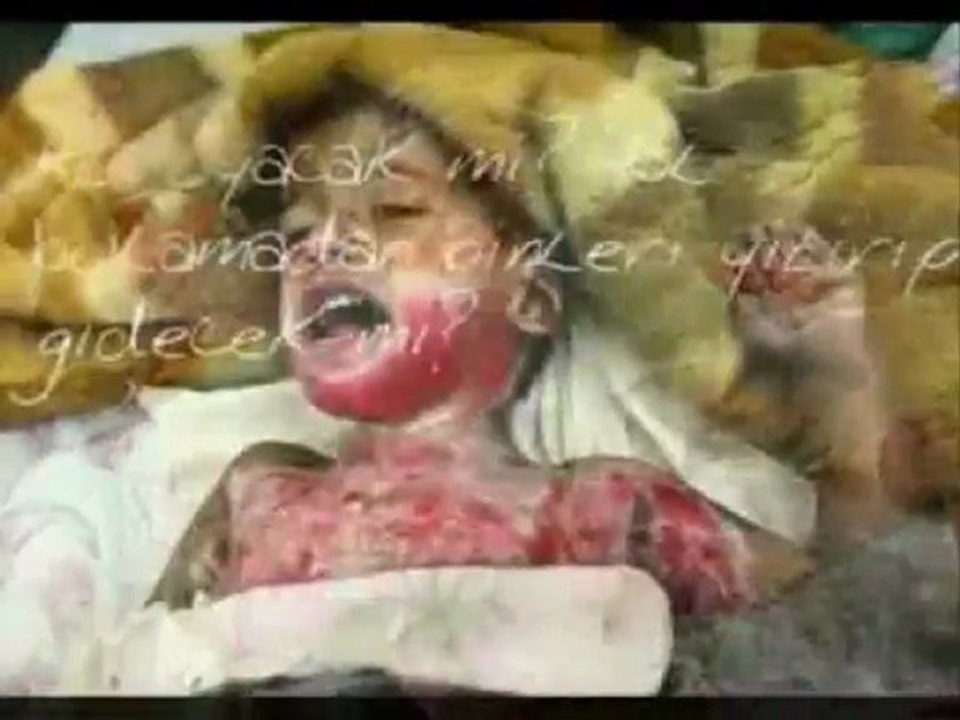 Katliam denilince akla ESAD değil ABD ve İsrail gelmeli, Türkiye Suriye'ye değil bu ikiliye askeri operasyon yapmalı