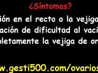 que es quistes de ovario, sintomas quistes de ovario, que son quistes de ovario