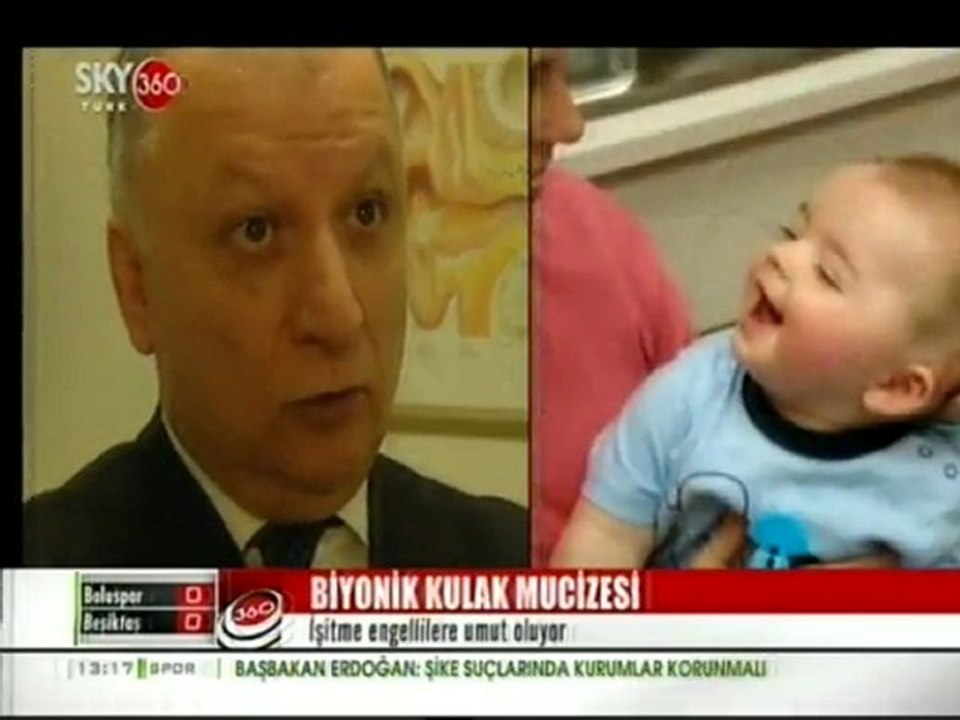 Biyonik Kulak Mucizesi