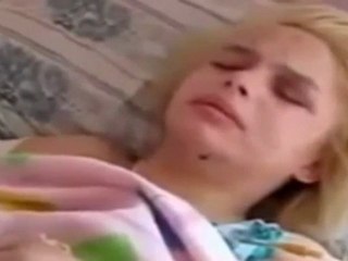 Una ucraniana violada y quemada cuenta su historia