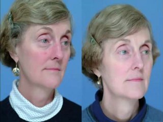 Skin Whitening Home Remedies--[Advantages of Homemade Skin Whitening Products]