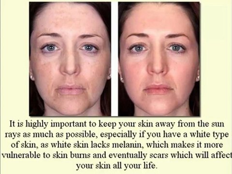 Skin Whitening Natural Products [ Between Beauty and Health]