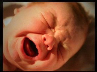 Eosinophilic Esophagitis in Children