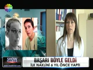 Yüz naklinde başarı böyle geldi -  22 mart 2012