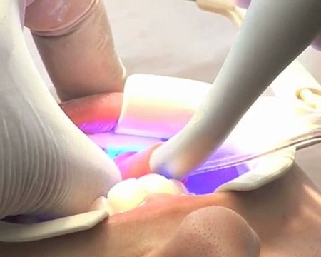 Hospitadent hangi diş tedavilerini uyguluyor?-Selçuk Özbölük