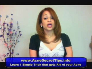 What cures Acne ?  Natural cures for acne