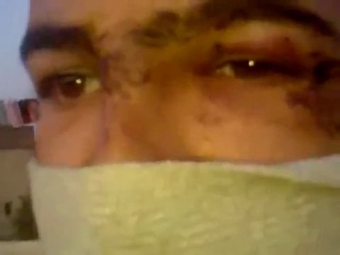فري برس حماه المحتلة قسطون تعذيب أحد المتظاهرين 2012 3 23