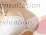 (Breast Augmentation Orange County CA) Cosmetic Surgery Advisors 855-488-DOCS (3627)
