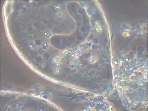 Observation de prélèvements de biomasses du pilote de Valenton