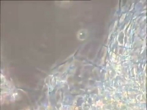 Examen de l'eau de lavage du Biofor