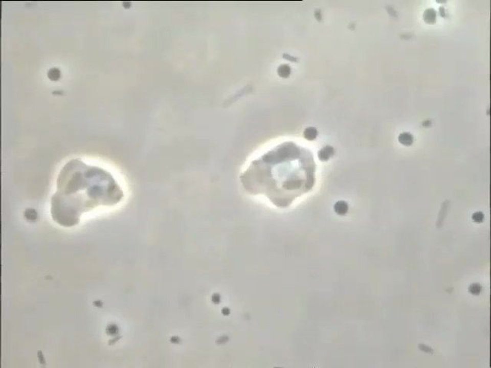 Prélèvement de Colombes : microfaune des flocs à fort grossissement - prédation par amibes
