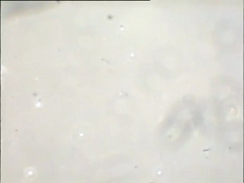 Examen de l'eau brute d 'Achères