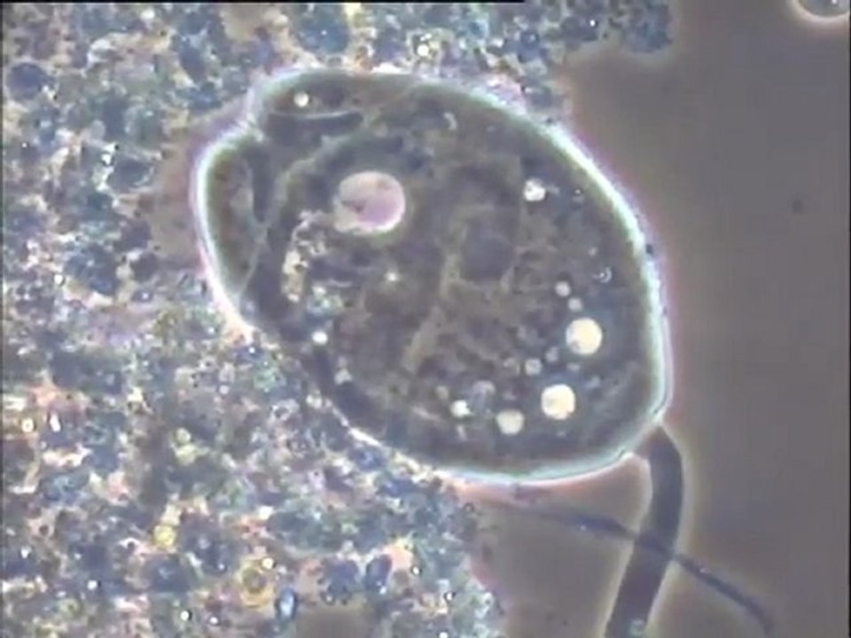 Examen de boues activées au microscope de la station de Donges - bassins D11 A et D11B