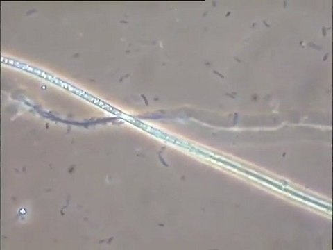 Examen au microscope de plusieurs boues activées de stations différentes (Marseille, Le Mans, Colombes)