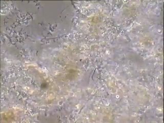 Examen d'une boue à filaments