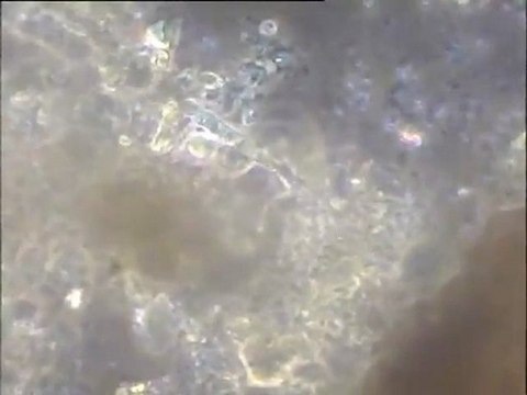 Observation de prélèvements de sédiment de l'étang des Noës : détail de la microfaune